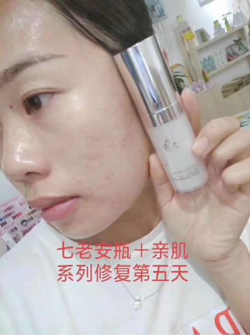 皮肤肤质测试方法‍