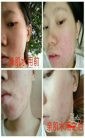 七老护肤品功效