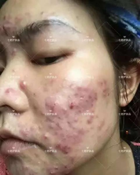 没用七老前